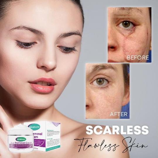 Medease Skin Rebound Cream - Image 2