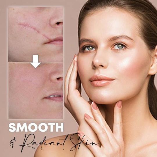 Medease Skin Rebound Cream - Image 3