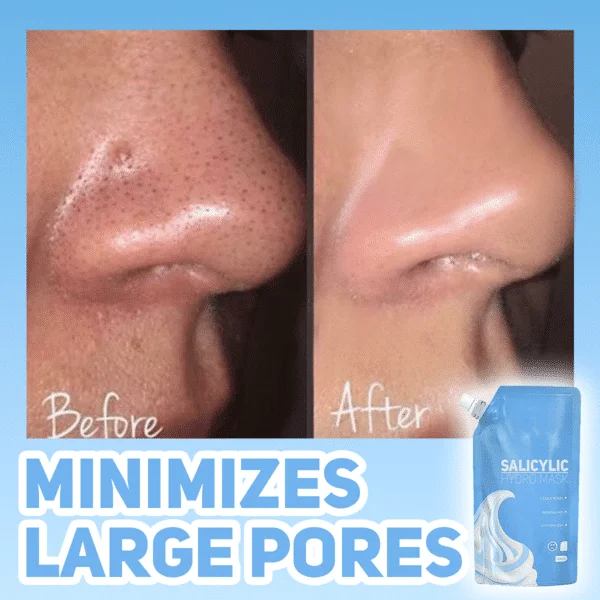 Salicylová hydromaska - Image 3