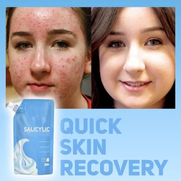 Salicylová hydromaska - Image 4