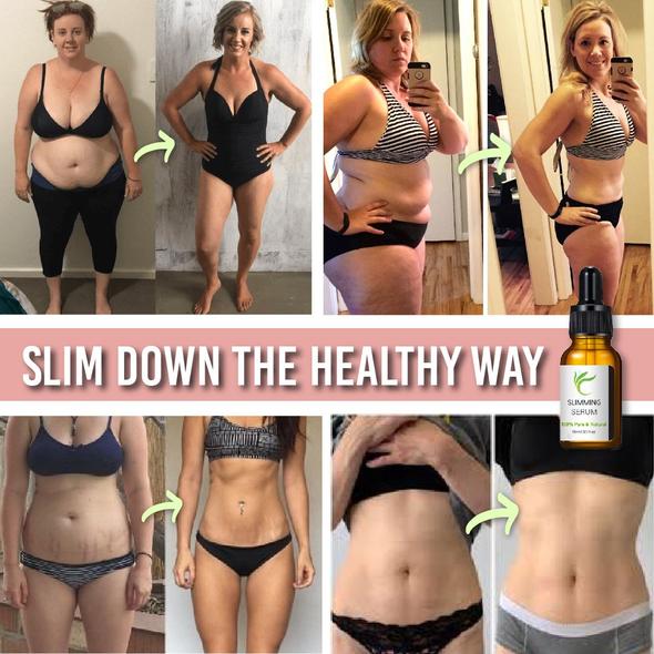 Tummy Tuck Bels so sérom na spaľovanie tukov - Image 6