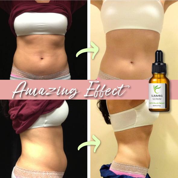 Tummy Tuck Bels so sérom na spaľovanie tukov - Image 7