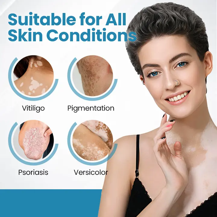 Zariadenie na terapiu Vitiligo Acezozla® DermaBeam - Image 2