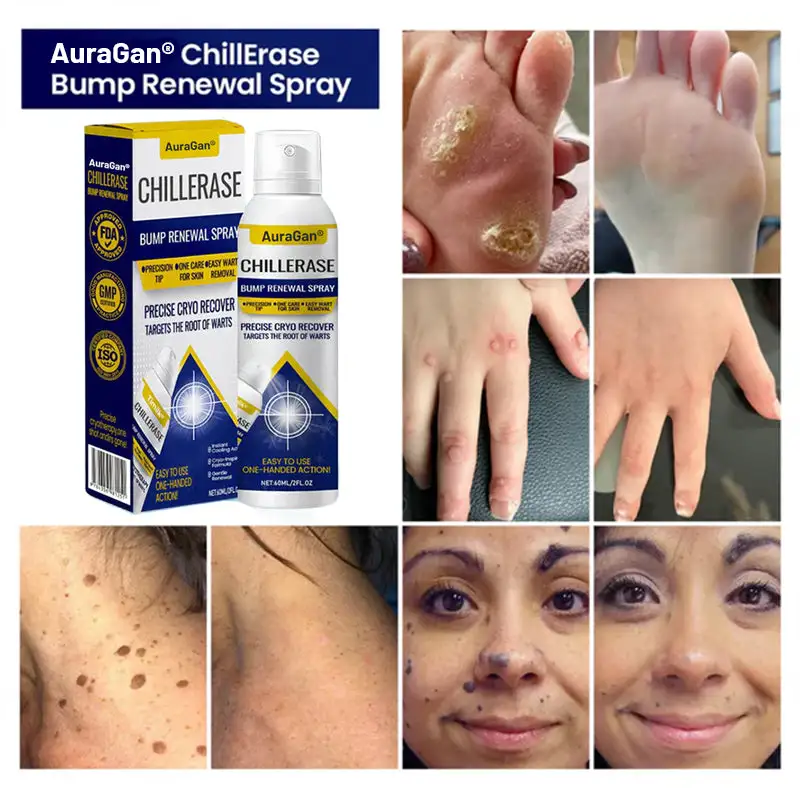 AuraGan® ChillErase sprej na obnovu nárazov - Image 4