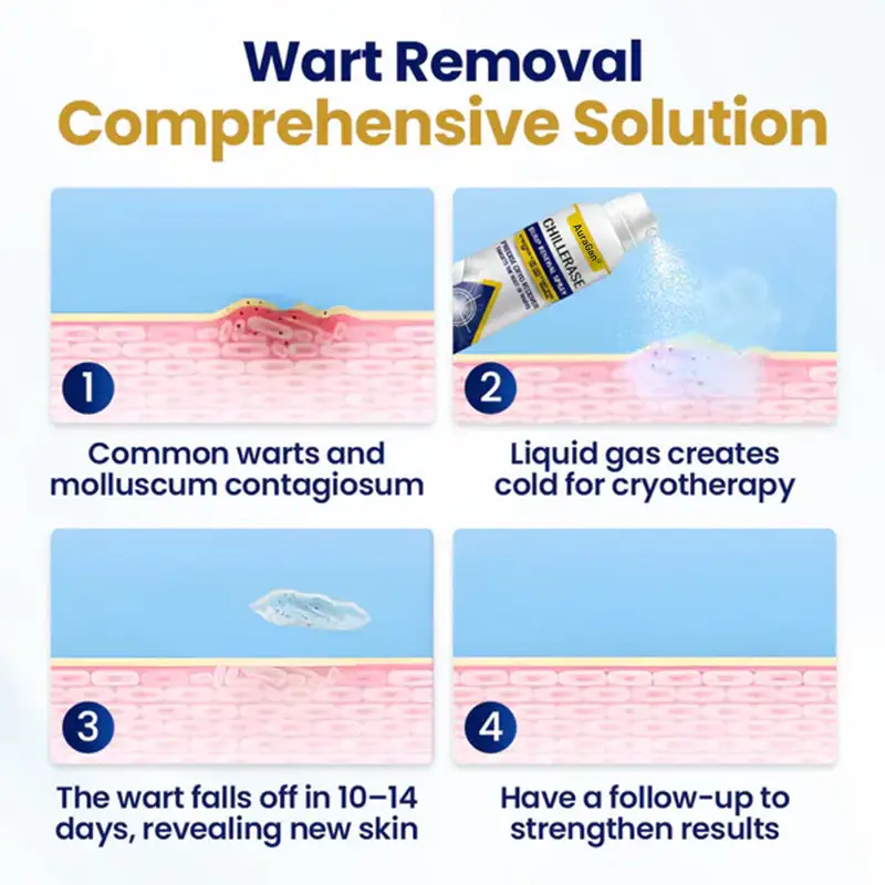 AuraGan® ChillErase sprej na obnovu nárazov - Image 6