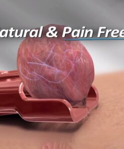 Medený odstraňovač kožných štítkov