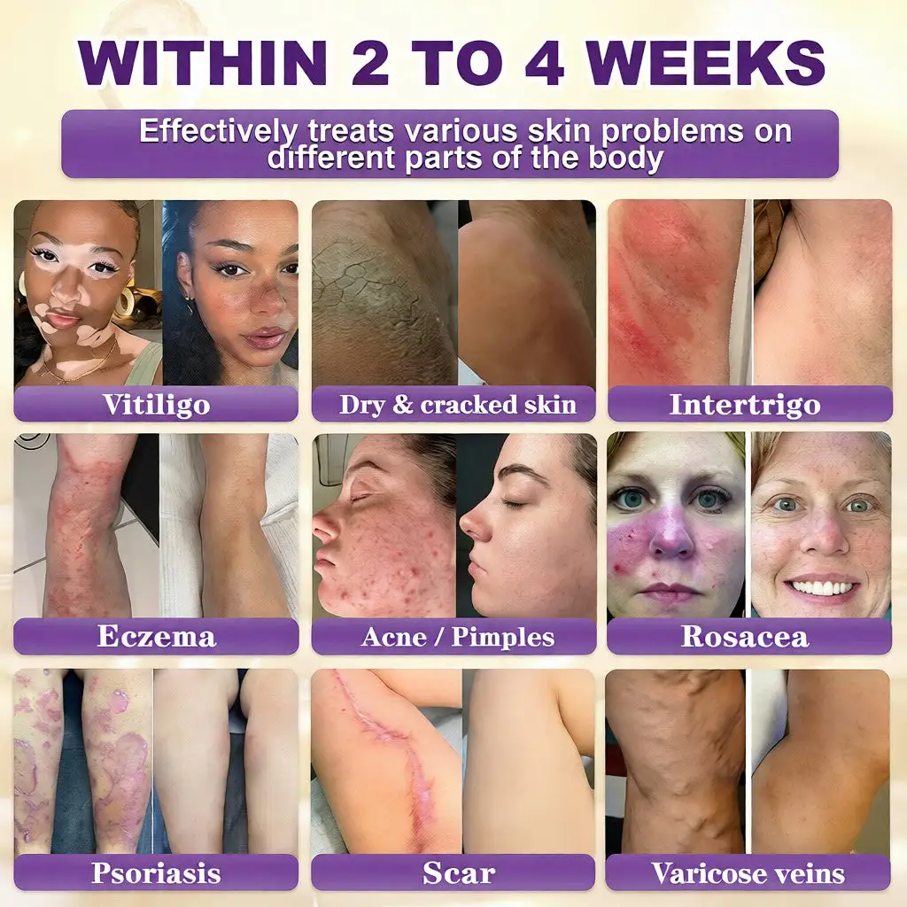 VORLORA® Biotín 10-v-1 krém na obnovu pleti - Image 2