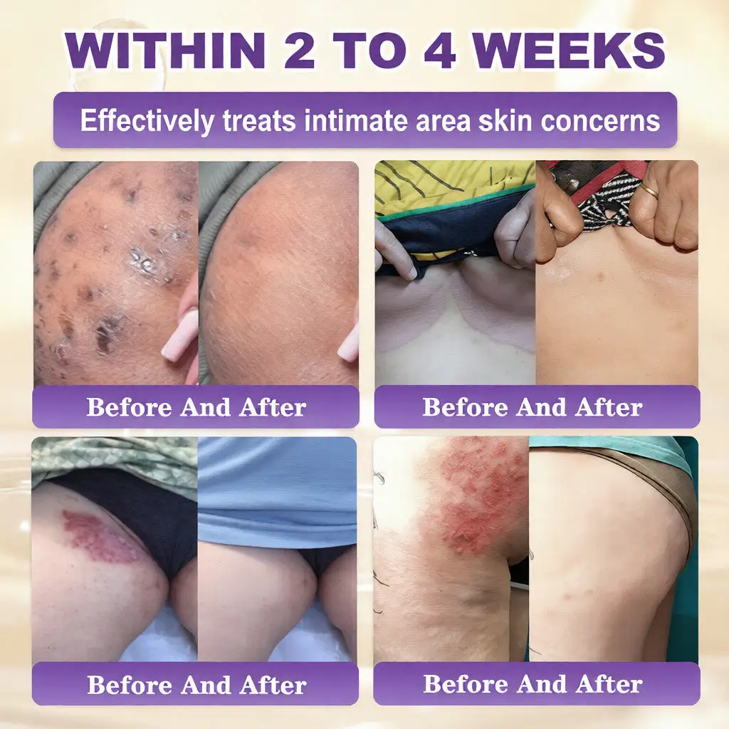 VORLORA® Biotín 10-v-1 krém na obnovu pleti - Image 4