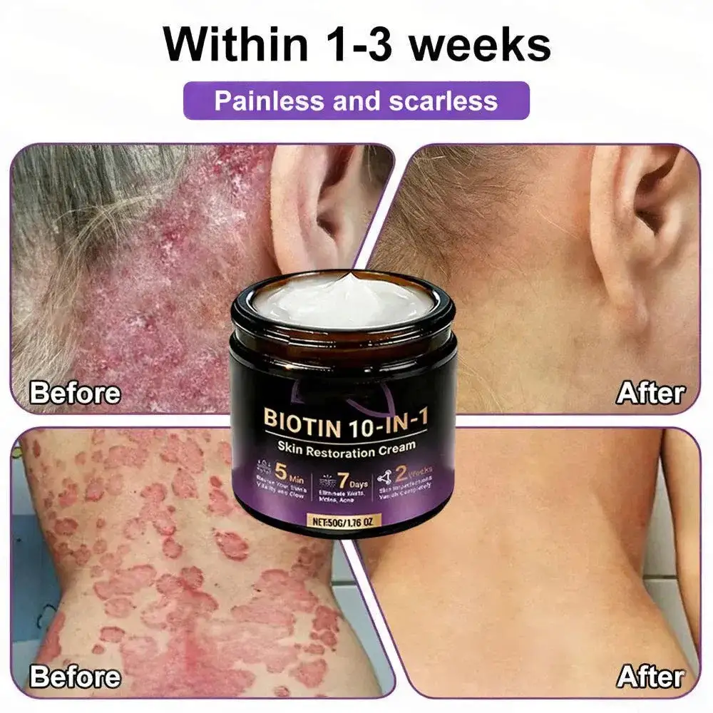 VORLORA® Biotín 10-v-1 krém na obnovu pleti - Image 5