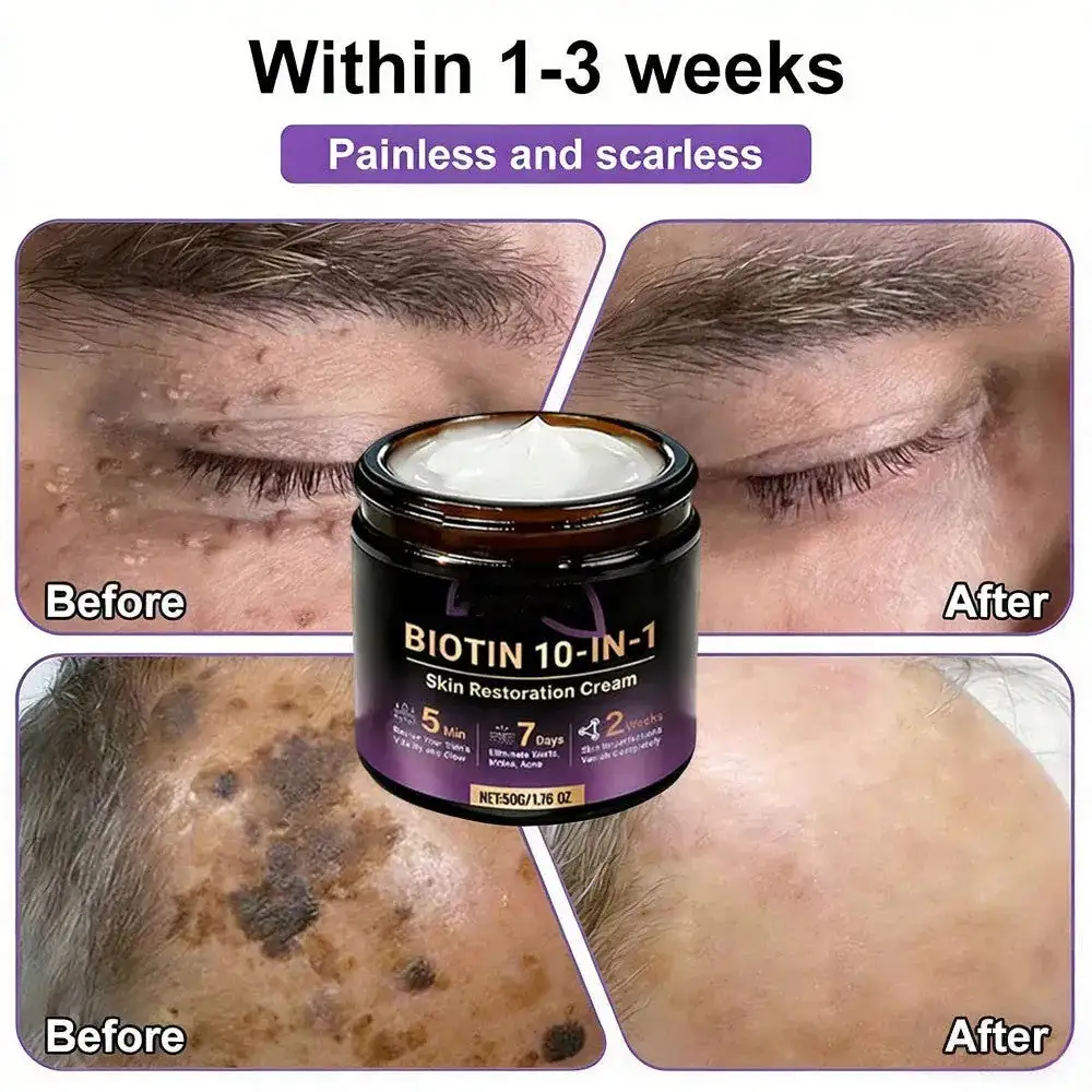 VORLORA® Biotín 10-v-1 krém na obnovu pleti - Image 7