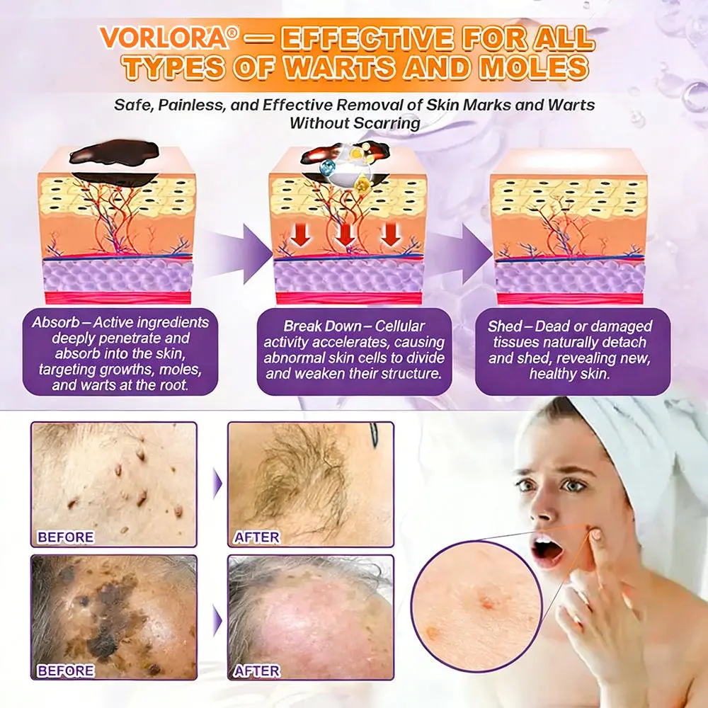 VORLORA® Biotín 10-v-1 krém na obnovu pleti - Image 9