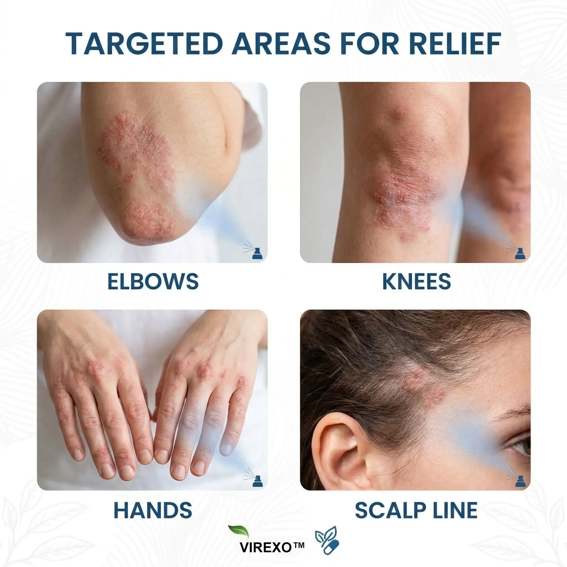 Virexo™ horčíkový botanický sprej - Image 2