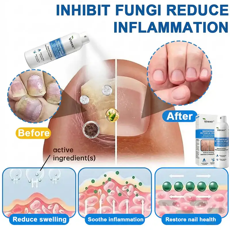 Virexo™ horčíkový botanický sprej - Image 4