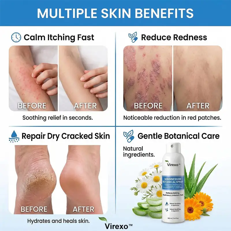 Virexo™ horčíkový botanický sprej - Image 9